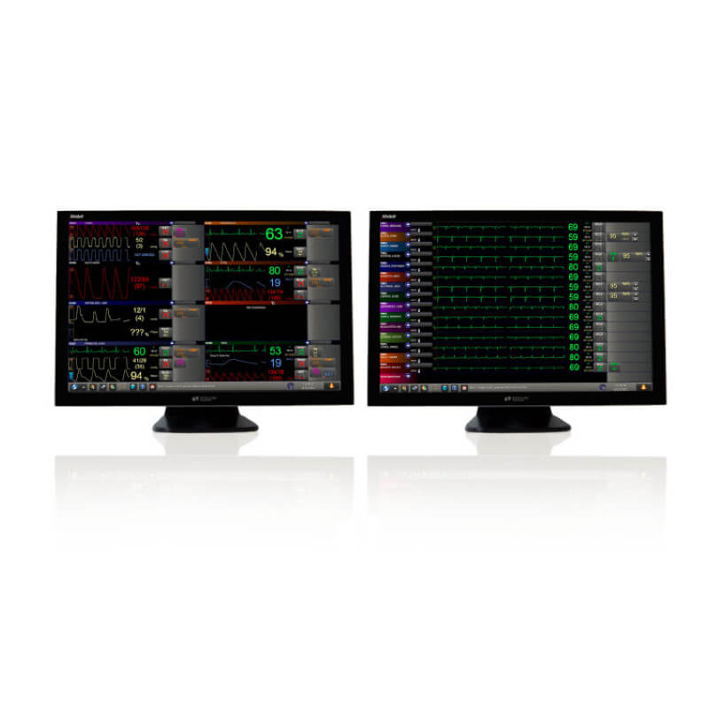 Central de monitoreo Xhibit, Spacelabs