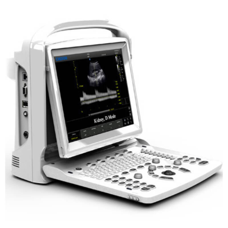 Ecógrafo Portátil Chison ECO3 Expert