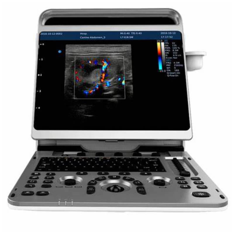 Ecógrafo portátil Ebit 30, Chison