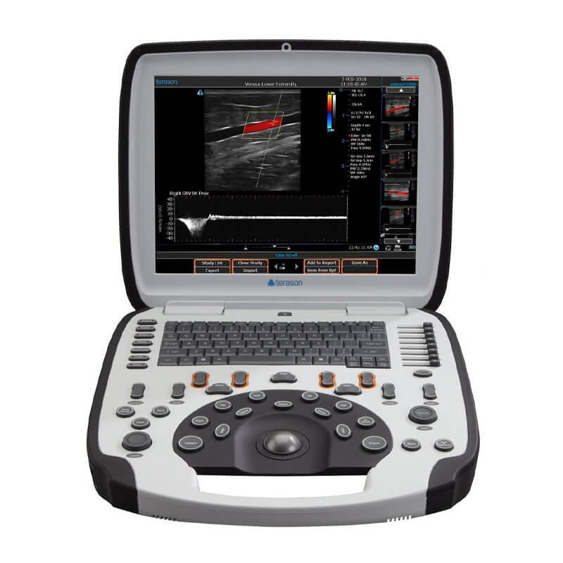 Ecógrafo portátil, sistema de conexión remota con un transductor USMART 3300, Terason