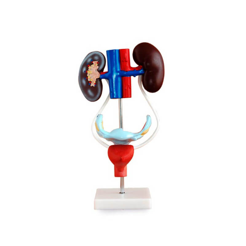 Sistema urogenital femenino